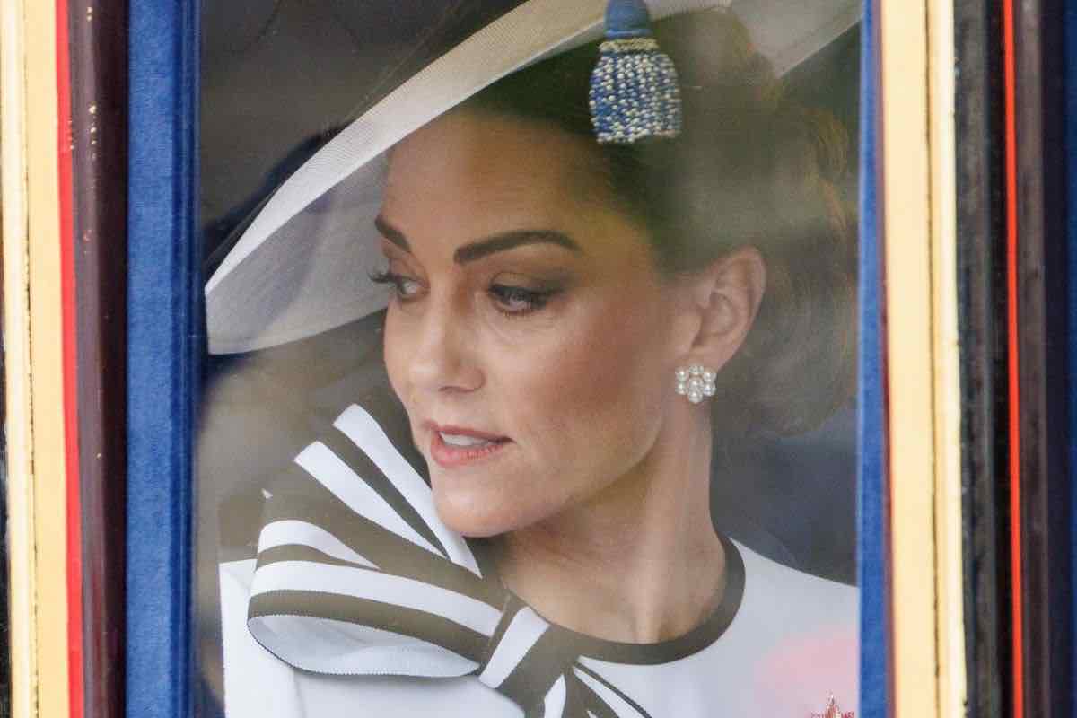 Kate Middleton cicatrice nascosta sul volto 